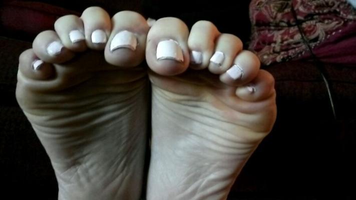 dedos de los pies blancos suelas calientes