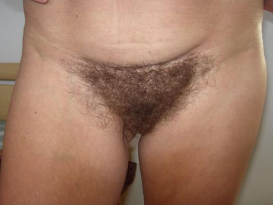 Big Hairy Massive Milf Minge