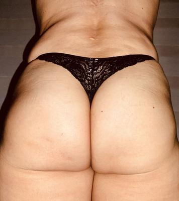 MIS RICAS NALGOTAS