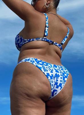 Some Sexy Cellulite to Brighten Your Mood